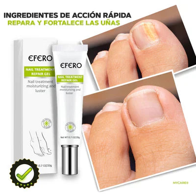 GEL ELIMINADOR DE HONGOS EN LOS PIES - MYCARE®